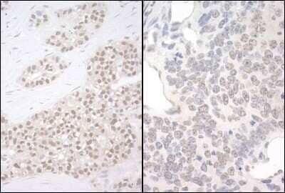 Immunohistochemistry: PQBP1 Antibody [NBP1-47271]