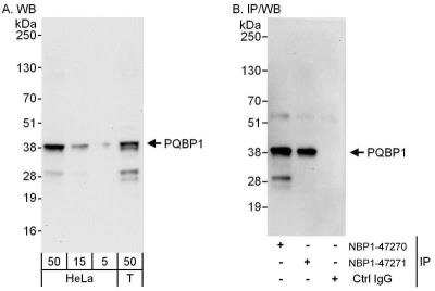 Western Blot: PQBP1 Antibody [NBP1-47270]