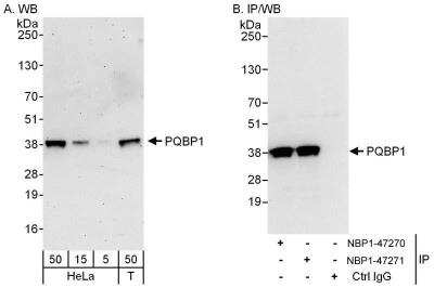 Western Blot: PQBP1 Antibody [NBP1-47271]