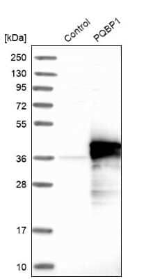 Western Blot: PQBP1 Antibody [NBP1-82619]