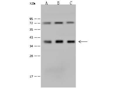 Western Blot: PQBP1 Antibody [NBP2-99606]