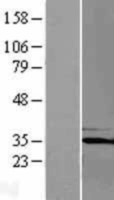 Western Blot: PQBP1 Overexpression Lysate [NBL1-14717]