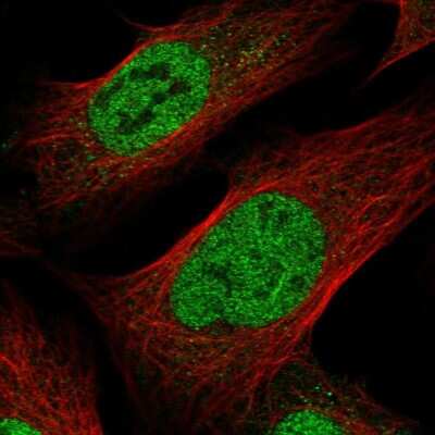 Immunocytochemistry/ Immunofluorescence: PQLC1 Antibody [NBP2-13806]