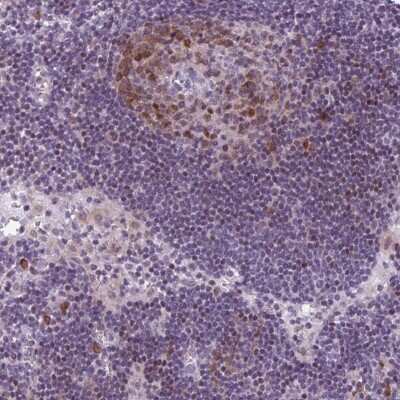 Immunohistochemistry-Paraffin: PQLC1 Antibody [NBP2-13806]