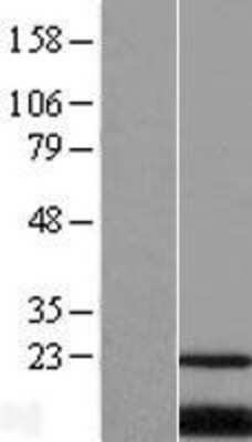 Western Blot: PQLC2 Overexpression Lysate [NBL1-14719]