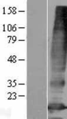 Western Blot: PQLC3 Overexpression Lysate [NBP2-05374]