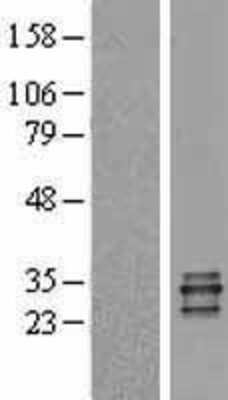 Western Blot: Proteinase 3/Myeloblastin/PRTN3 Overexpression Lysate [NBL1-14851]