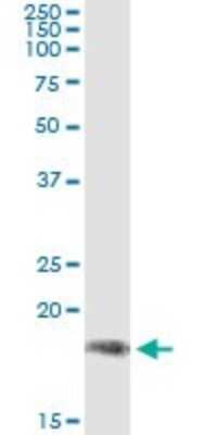 Immunoprecipitation: PR48 Antibody (1F4) [H00028227-M14]