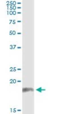 Western Blot: PR48 Antibody (2E12) [H00028227-M08]