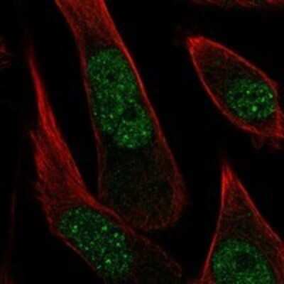 Immunocytochemistry/ Immunofluorescence: PR48 Antibody [NBP3-17915]