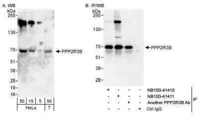 Western Blot: PR48 Antibody [NB100-41411]