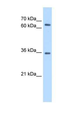 Western Blot: PR48 Antibody [NBP1-58174]