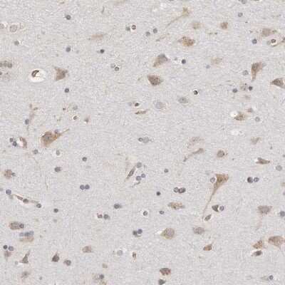 Immunohistochemistry-Paraffin: PRA1 Antibody [NBP1-80883]