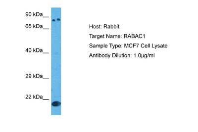 Western Blot: PRA1 Antibody [NBP2-85522]