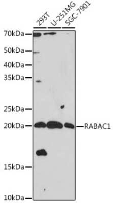 Western Blot: PRA1 AntibodyAzide and BSA Free [NBP3-15956]