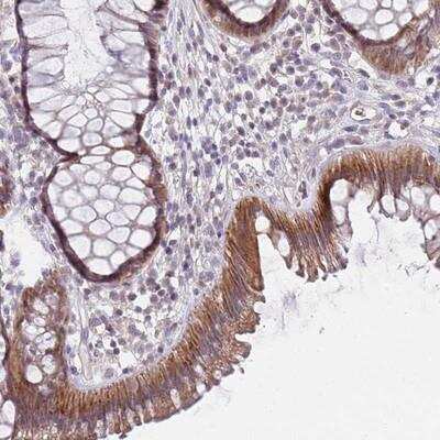 Immunohistochemistry-Paraffin: PRAC Antibody [NBP2-13807]