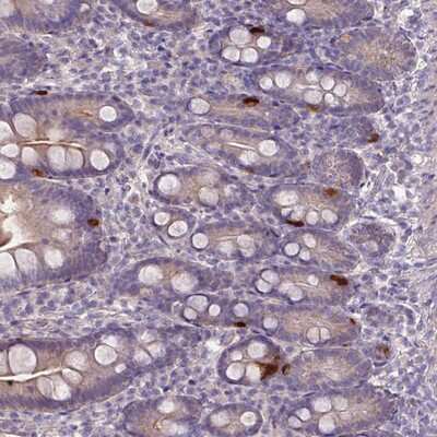 Immunohistochemistry-Paraffin: PRADC1/PAP21 Antibody [NBP2-13808]