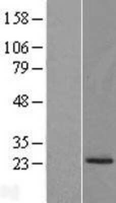 Western Blot: PRADC1/PAP21 Overexpression Lysate [NBL1-08430]