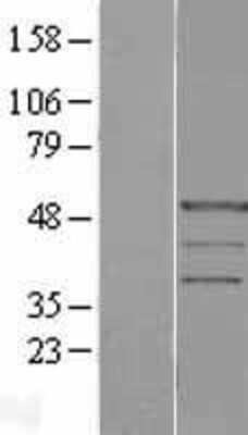 Western Blot: PRAF1 Overexpression Lysate [NBL1-14578]