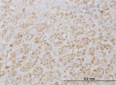 Immunohistochemistry-Paraffin: PRAGMIN Antibody (5C6) [H00157285-M01]