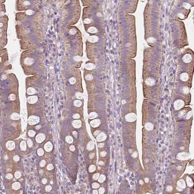 Immunohistochemistry-Paraffin: PRAGMIN Antibody [NBP1-87473]