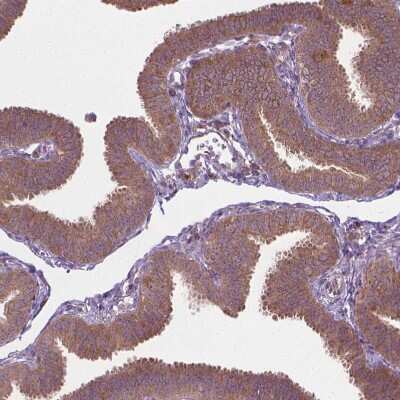 Immunohistochemistry-Paraffin: PRAGMIN Antibody [NBP1-87473]