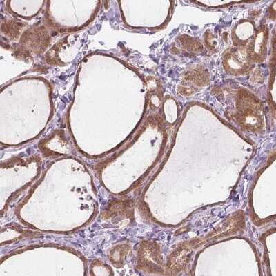 Immunohistochemistry-Paraffin: PRAGMIN Antibody [NBP1-87473]