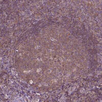 Immunohistochemistry-Paraffin: PRAGMIN Antibody [NBP1-87473]