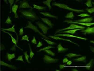Immunocytochemistry/ Immunofluorescence: PRAK Antibody (3D7) [H00008550-M02]