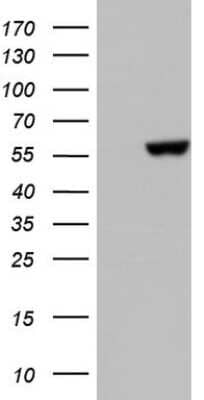 Western Blot: PRAK Antibody (OTI5E1) [NBP2-45753]