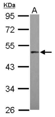 Western Blot: PRAK Antibody [NBP2-19922]