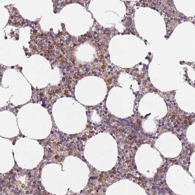 Immunohistochemistry-Paraffin: PRAM1 Antibody [NBP2-13809]