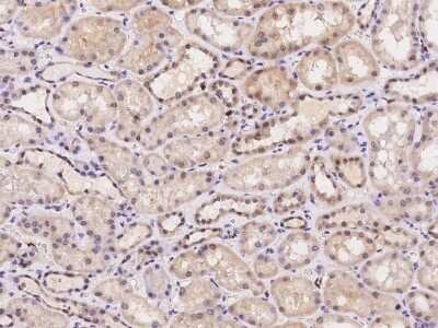 Immunohistochemistry-Paraffin: PRAM1 Antibody [NBP2-98045]