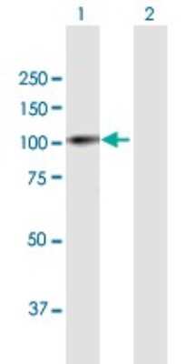 Western Blot: PRAM1 Antibody [H00084106-B01P]