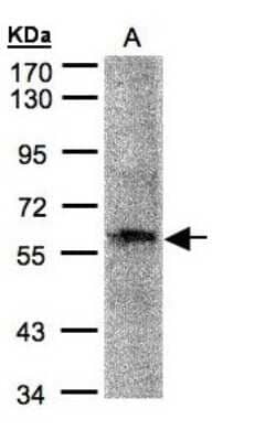 Western Blot: PRAM1 Antibody [NBP1-31075]