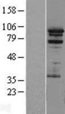 Western Blot: PRAM1 Overexpression Lysate [NBL1-14722]