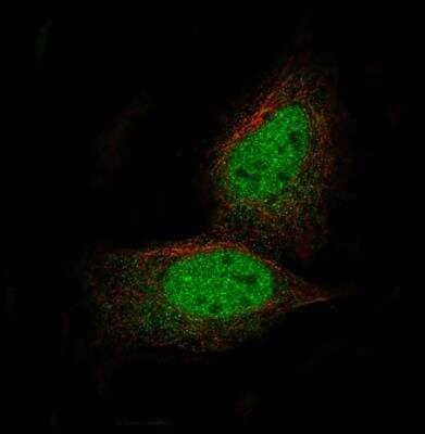 Immunocytochemistry/ Immunofluorescence: PRAME Antibody (CL5146) [NBP2-61148]