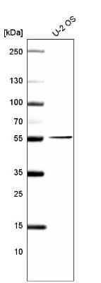 Western Blot: PRAME Antibody (CL5146) [NBP2-61148]