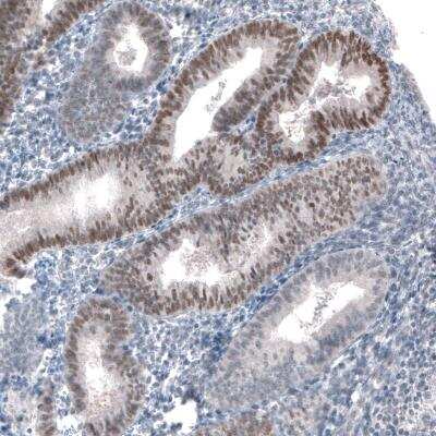 Immunohistochemistry-Paraffin: PRAME Antibody (CL5148) [NBP2-61149]