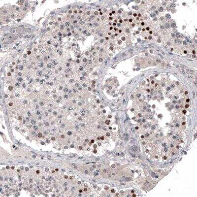 Immunohistochemistry-Paraffin: PRAME Antibody (CL5148) [NBP2-61149]