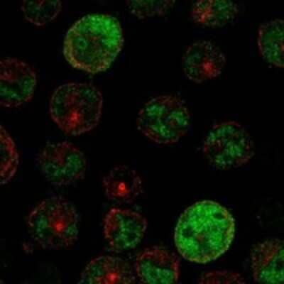 Immunocytochemistry/ Immunofluorescence: PRAME Antibody [NBP3-17674]