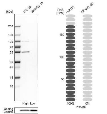 Western Blot: PRAME Antibody [NBP1-85418]