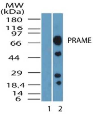 Western Blot: PRAME Antibody [NBP2-23670]