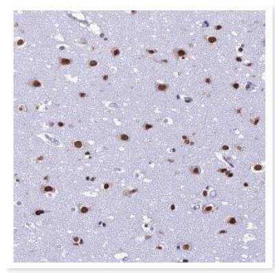 Immunohistochemistry: PRAME Family Member 12 Antibody [NBP2-23613]