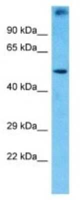 Western Blot: PRAMEF1 Antibody [NBP3-09880]