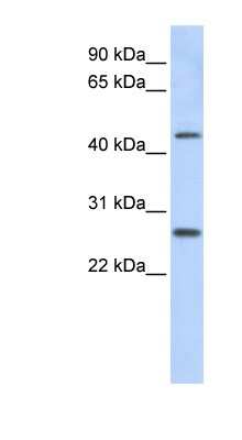 Western Blot: PRAMEF10 Antibody [NBP1-56432]