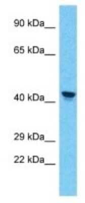 Western Blot: PRAMEF11 Antibody [NBP3-09923]