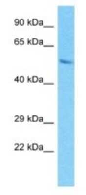 Western Blot: PRAMEF15 Antibody [NBP3-09881]