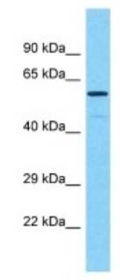 Western Blot: PRAMEF17 Antibody [NBP3-09882]