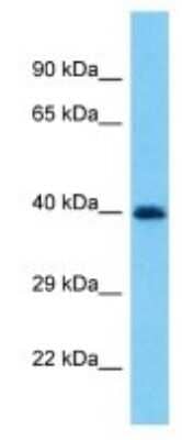 Western Blot: PRAMEF19 Antibody [NBP3-09924]